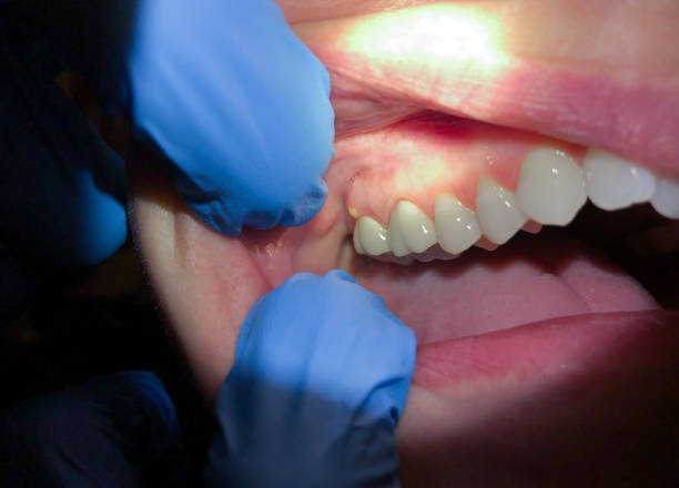 Best Emergency Dentist for Special Needs Patients in Tarboro, NC